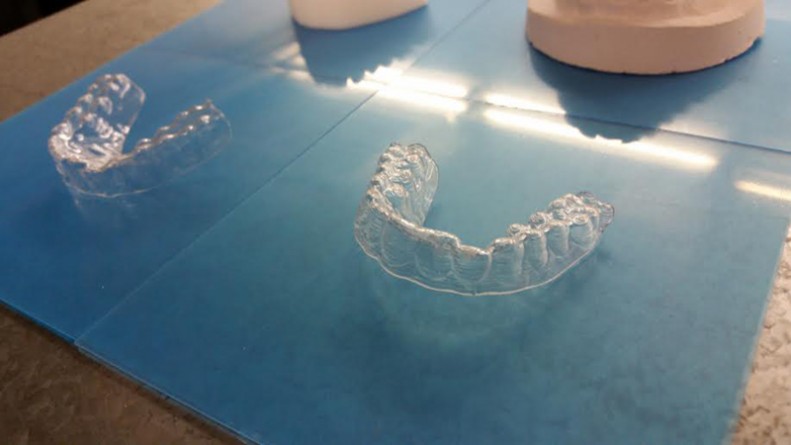 В мире: Студент из Нью-Джерси выравнял зубы благодаря самостоятельно разработанным и распечатанным на 3D-принтере брэкетам
