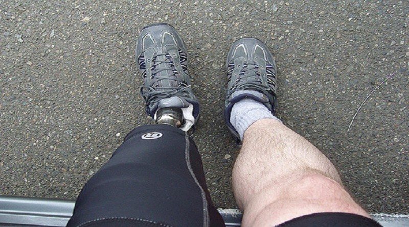 Врачебная ошибка стала причиной ужасной трагедии 30052016 Здоровье и красота: Врачебная ошибка стала причиной ужасной трагедии