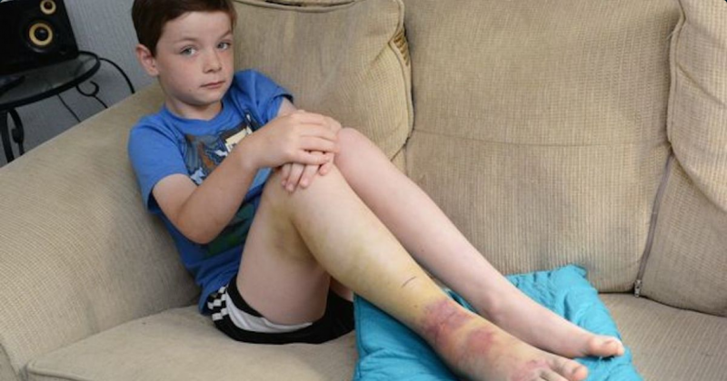 Происшествия: На 8-летнего мальчика напала ядовитая змея