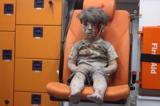 В мире: Фотография, шокировавшая мир: раненый мальчик из Сирии