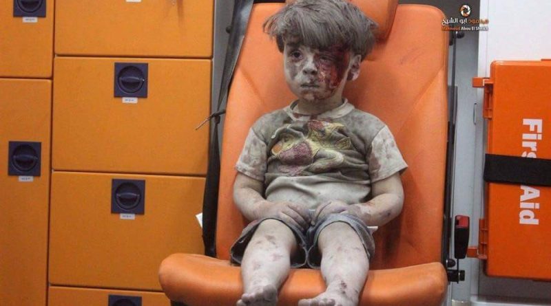 Фотография, шокировавшая мир: раненый мальчик из Сирии 18082016 В мире: Фотография, шокировавшая мир: раненый мальчик из Сирии