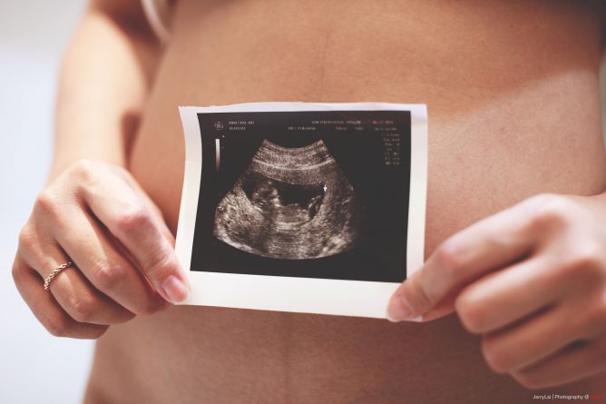 Здоровье и красота: В Британии узаконили зачатие ребенка сразу от трех родителей