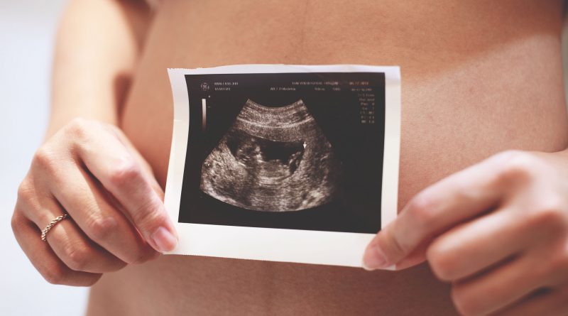 Здоровье и красота: В Британии узаконили зачатие ребенка сразу от трех родителей