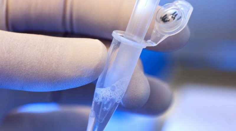 Британские ученые совершили прорыв в диагностике туберкулеза 24032017 Здоровье и красота: Британские ученые совершили прорыв в диагностике туберкулеза