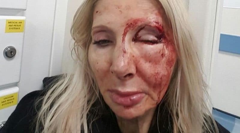 Происшествия: Туристку избили возле станции метро