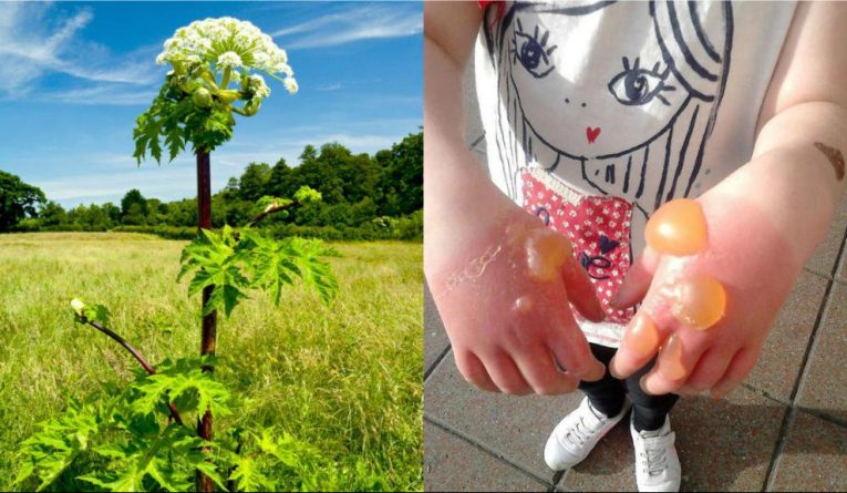 Здоровье и красота: Теплое лето в Британии привело к распространению ядовитого сорняка