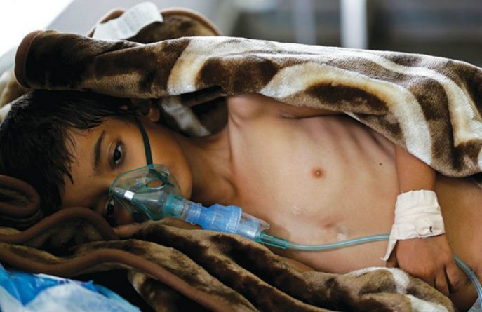 В мире: Число заразившихся холерой в Йемене превысило 100,000