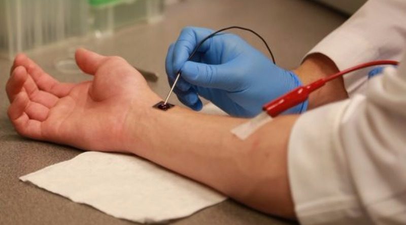 Здоровье и красота: Биоинженеры разработали чип, ускоряющий заживление ран