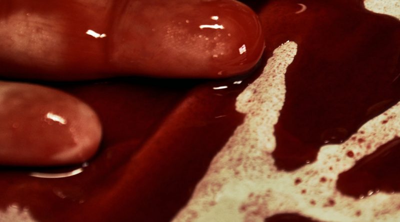 Боксер, избивший свою девушку, называет себя жертвой 02112017 Закон и право: Боксер, избивший свою девушку, называет себя жертвой