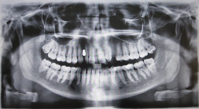 Здоровье и красота: Зубы британских детей в критическом состоянии