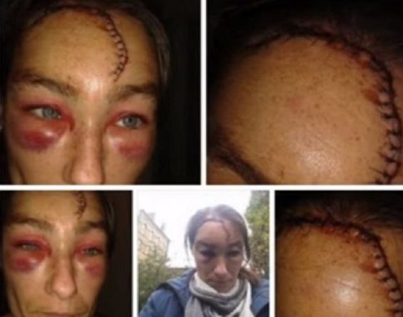 Происшествия: В Западном Йоркшире расисты изуродовали женщину