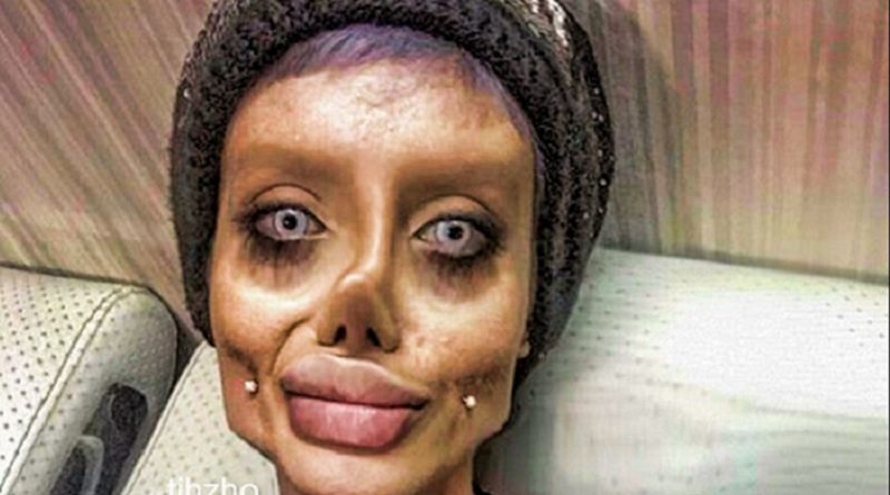Популярное: Юная иранка перенесла 50 операций, чтобы стать похожей на Анджелину Джоли