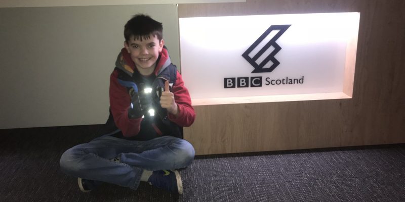 Общество: Эдинбургский мальчик получит на Рождество бионический протез руки