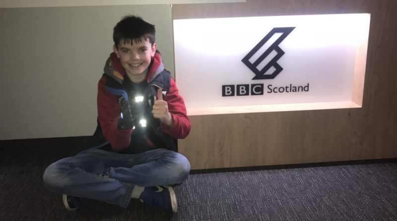 Эдинбургский мальчик получит на Рождество бионический протез руки 24122017 Общество: Эдинбургский мальчик получит на Рождество бионический протез руки