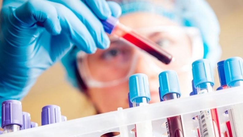Здоровье и красота: Создан универсальный тест крови для ранней диагностики рака