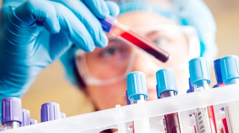 Создан универсальный тест крови для ранней диагностики рака 19012018 Здоровье и красота: Создан универсальный тест крови для ранней диагностики рака