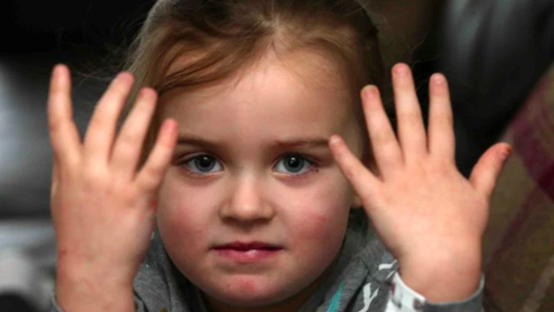 Происшествия: Девочка лишилась ногтей из-за детского лака от Hasbro