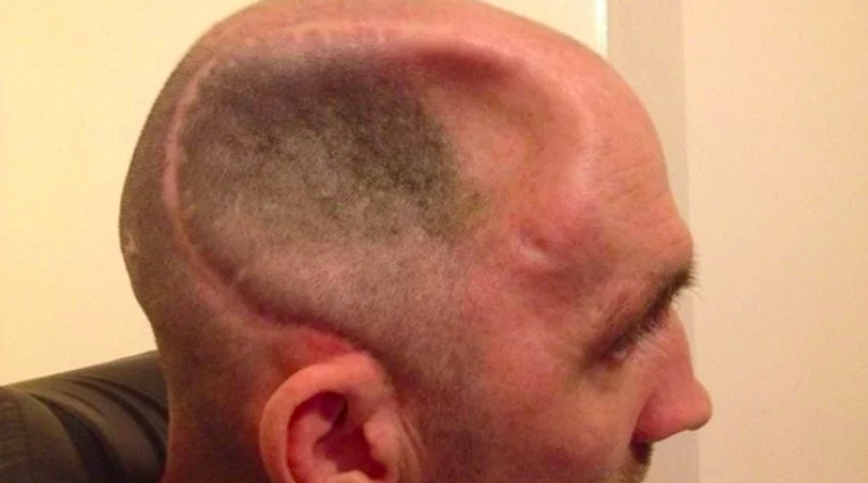 Происшествия: Один фатальный удар убил человека