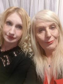 Знаменитая женщина-трансгендер поделилась в сетях снимками, сделанными после очередных косметических процедур рис 4