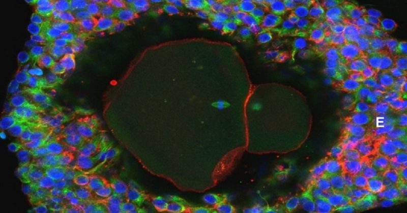 Здоровье и красота: Человеческие яйцеклетки впервые выращены в лабораторных условиях