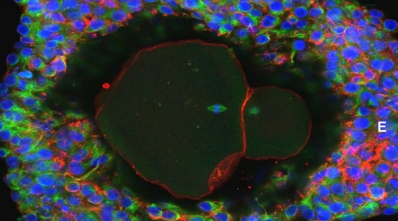 Человеческие яйцеклетки впервые выращены в лабораторных условиях 09022018 Здоровье и красота: Человеческие яйцеклетки впервые выращены в лабораторных условиях