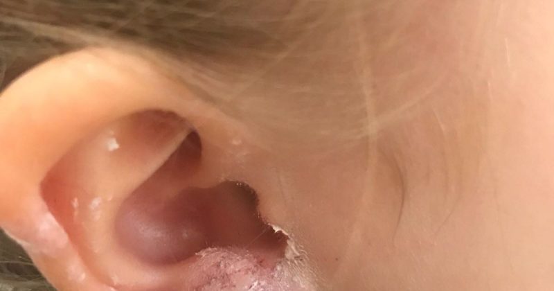 Общество: Мать в ярости: ее дочь едва не лишилась мочки уха из-за сережек с eBay за £2,99
