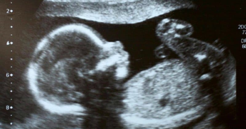 Популярное: Своеобразный тренд: беременные делают маникюр с изображением своих детей в утробе