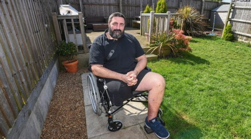 Мужчине ампутировали ногу после укуса ложной черной вдовы 08052018 Здоровье и красота: Мужчине ампутировали ногу после укуса ложной черной вдовы