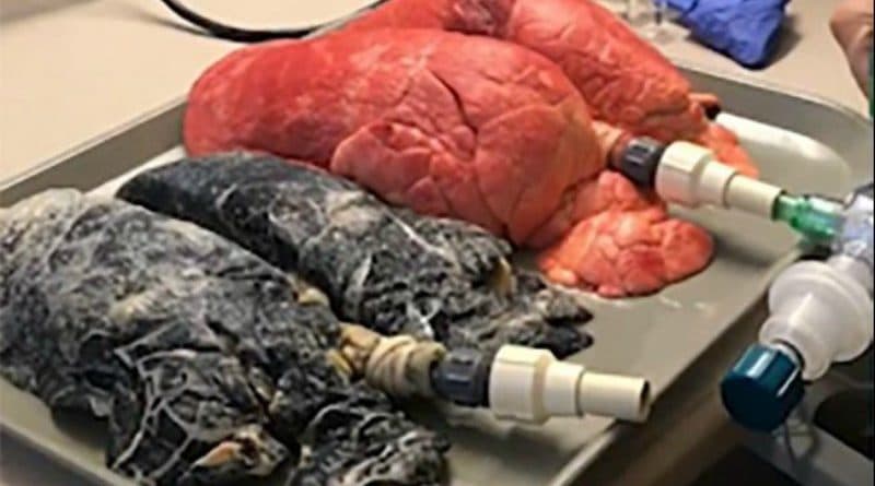 Здоровье и красота: Сигаретку? Видео, после которого в сторону сигарет даже не смотрят