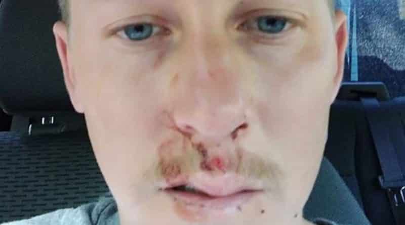 Здоровье и красота: Страшное предупреждение, почему вы никогда не должны пить в жару много холодной воды