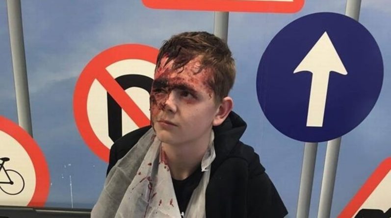 Общество: Хулиганы разбили молотком голову подростка из-за £1 и мобильного телефона