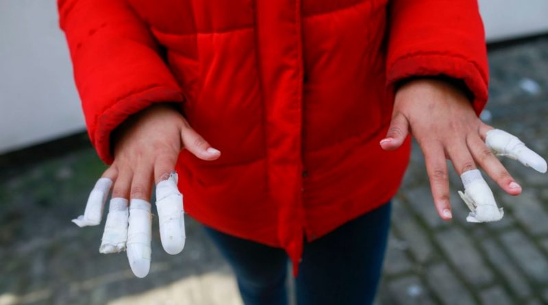 13-летней темнокожей девочке подростки сорвали ногти на почве расовой ненависти 18042019 Происшествия: 13-летней темнокожей девочке подростки сорвали ногти на почве расовой ненависти