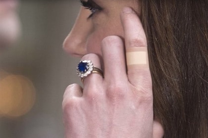 Общество: «Вечный» пластырь на пальцах Кейт Миддлтон озадачил поклонников