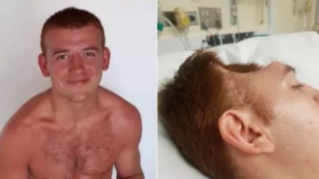 Без рубрики: Британец лишился части черепа после кошмарной поездки в магазин (18+). РЕН ТВ