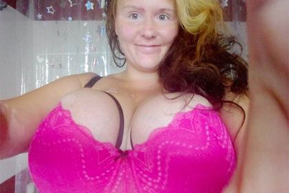 Общество: Женщина рассказала о тяжелой жизни с грудью 13 размера