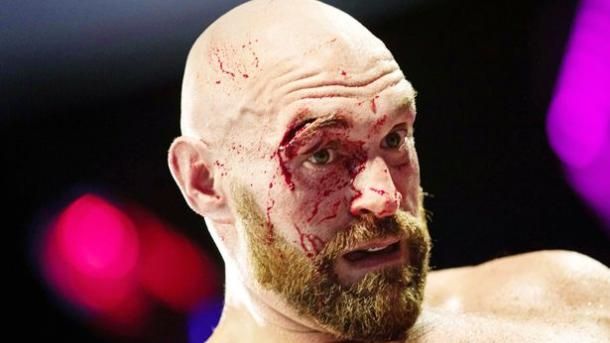 Общество: Британского тяжеловеса Фьюри после кровавого боя отстранили от бокса