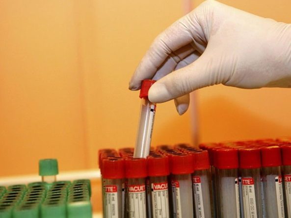 Общество: Учёные нашли «убежище» ВИЧ в организме пациента во время терапии