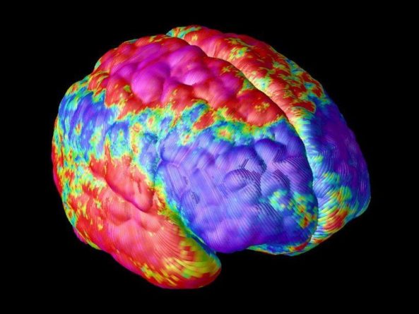 Общество: Уменьшение количества связей между нейронами мозга при шизофрении подтверждено на живых пациентах