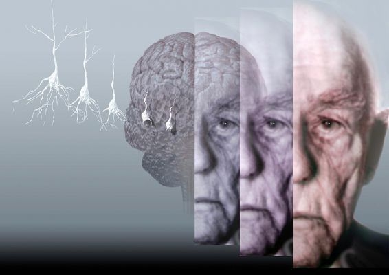 Общество: Открыты мутации, защищающие мозг от развития болезни Альцгеймера