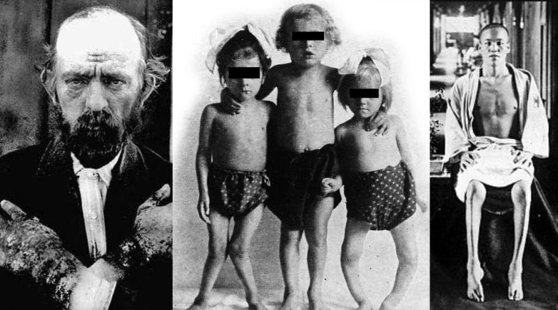 Общество: Живительный амин и его первооткрыватель