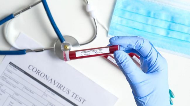 Общество: Молдавия резервирует тесты на коронавирус для Приднестровья