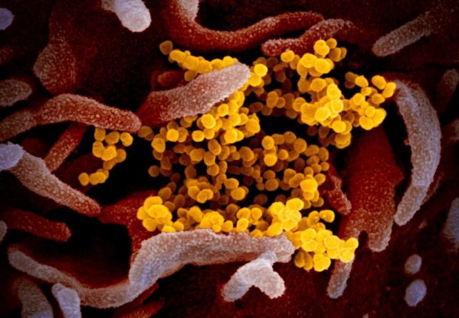Общество: Количество умерших от коронавируса в мире превысило 150 тысяч человек