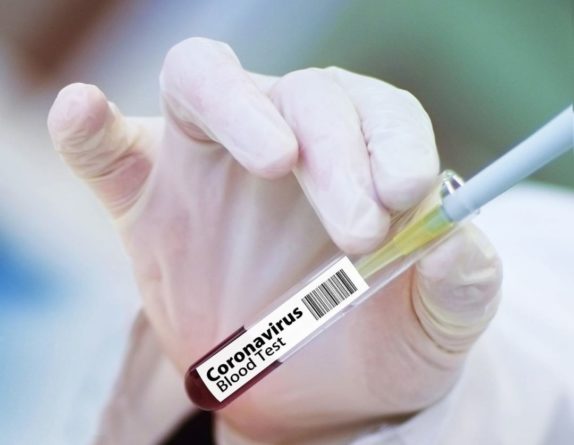 Ученые выяснили, от чего зависят симптомы COVID-19 - Cursorinfo: главные новости Израиля 28042020 Общество: Ученые выяснили, от чего зависят симптомы COVID-19 - Cursorinfo: главные новости Израиля