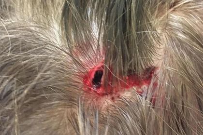 Общество: Мальчик остался с дырой в голове после нападения агрессивного лебедя