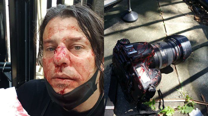 Общество: На акции протеста в Лондоне избили итальянского фотожурналиста