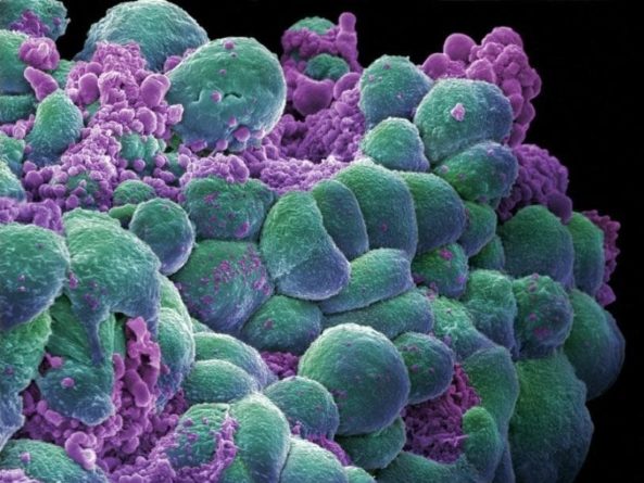 Общество: Инфракрасное излучение эффективно против редкого рака легких