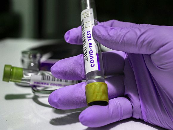 Общество: Британия не смогла взять под контроль распространение коронавируса