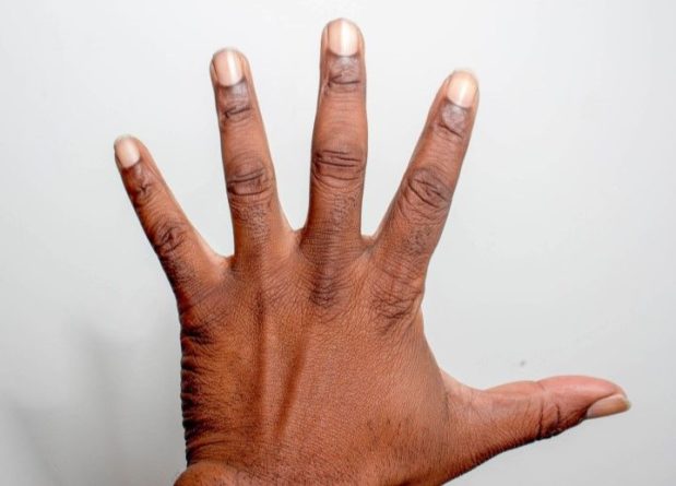 Общество: Новости из Англии: рак легких можно определить по виду пальцев рук и ногтей