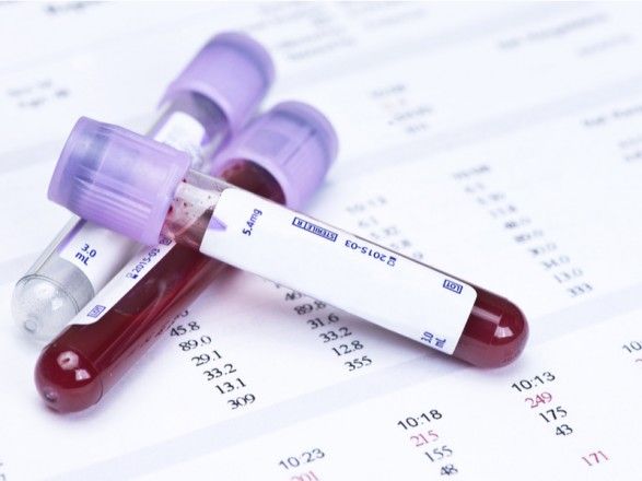 Общество: В Британии начнут испытания анализа крови, выявляющего 50 типов рака