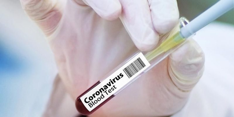 Общество: В Великобритании обнаружили еще одну мутацию коронавируса